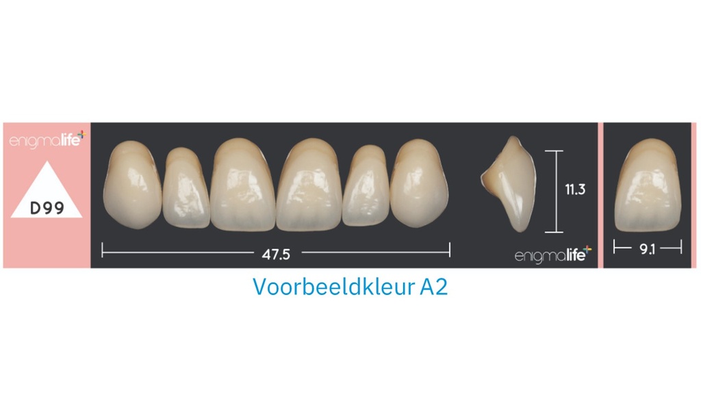 EnigmaLife+ Tandenset boven A1-D99
