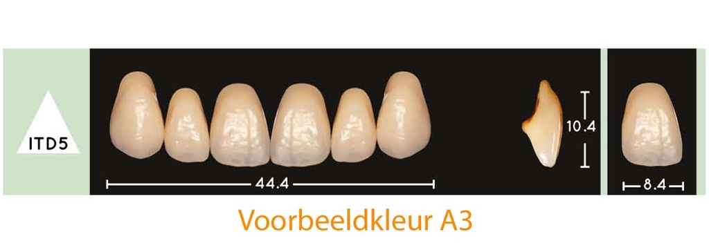 EnigmaLife+ Digital Tandenset boven A1-ITD5