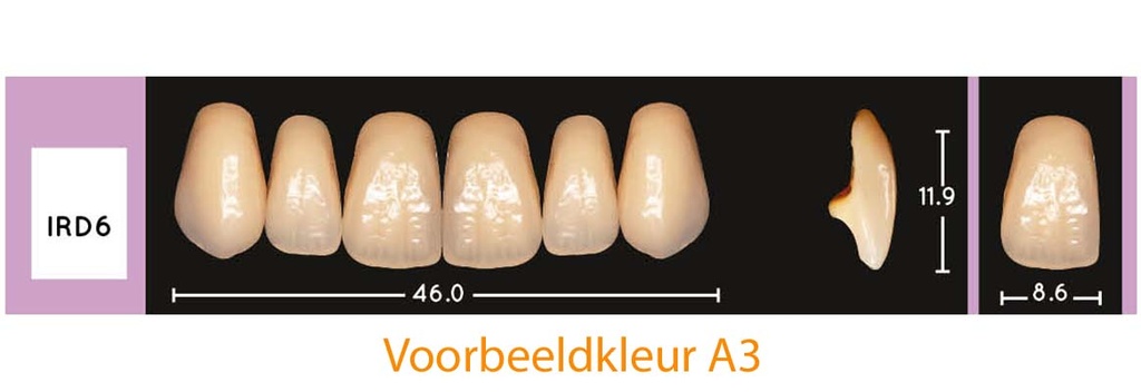 EnigmaLife+ Digital Tandenset boven B2-IRD6