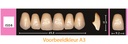 EnigmaLife+ Digital Tandenset boven A2-ISD8